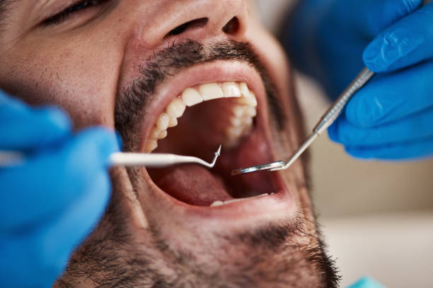 Emergency Dental Services in Combine, TX